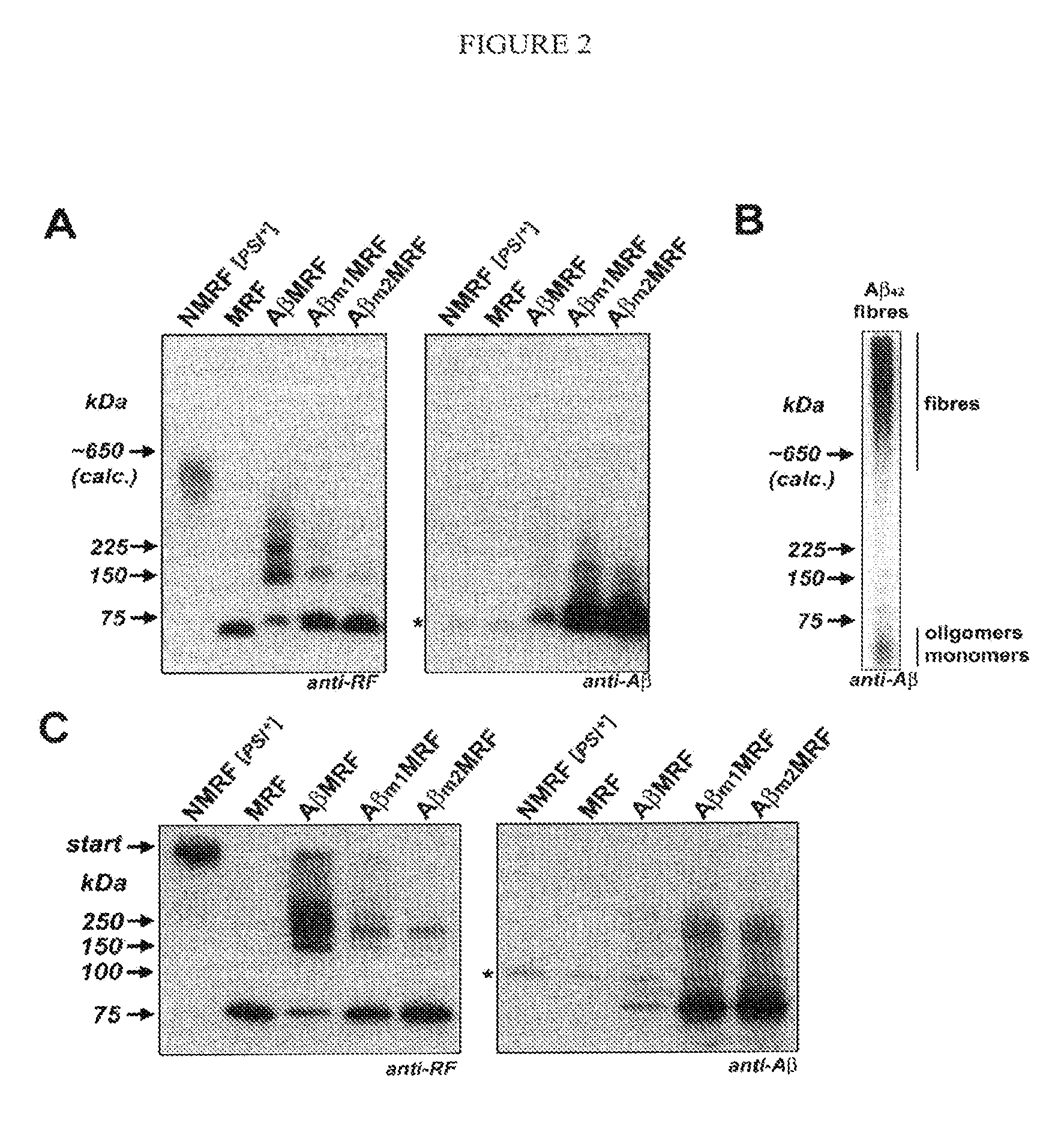 Yeast Reporter System