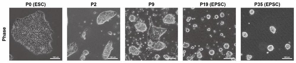 A special medium for transforming human pluripotent stem cells into expanded pluripotent stem cells and its application