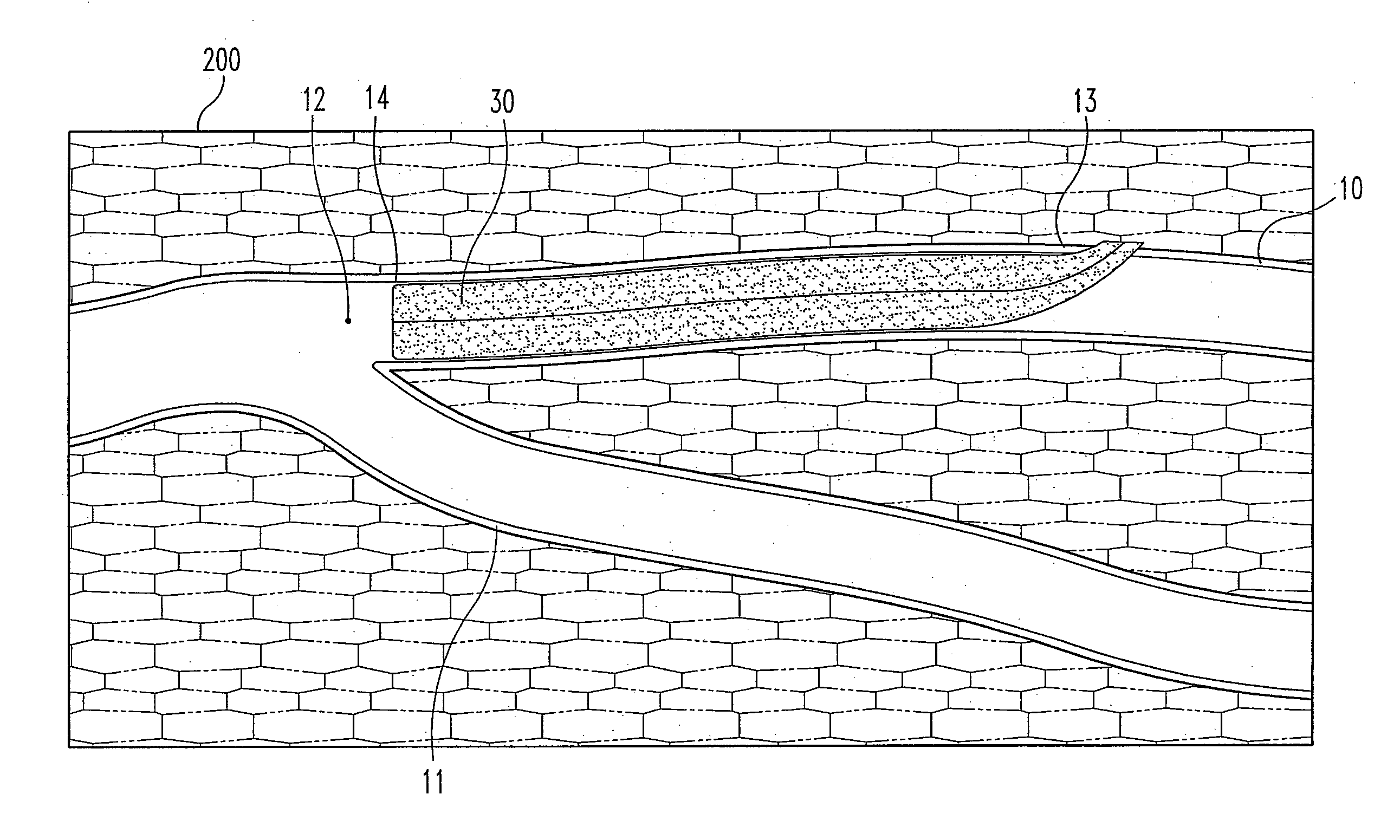 Methods, systems and devices for the delivery of endoluminal prostheses