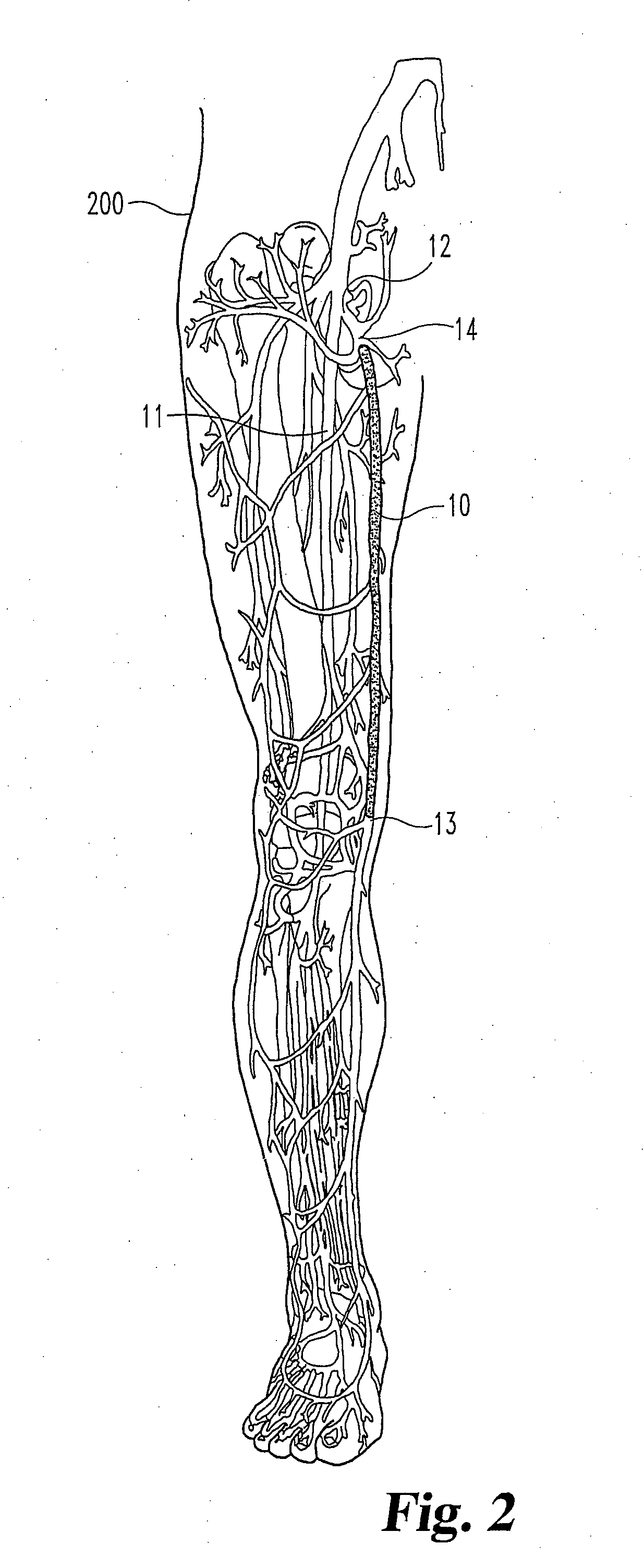 Methods, systems and devices for the delivery of endoluminal prostheses