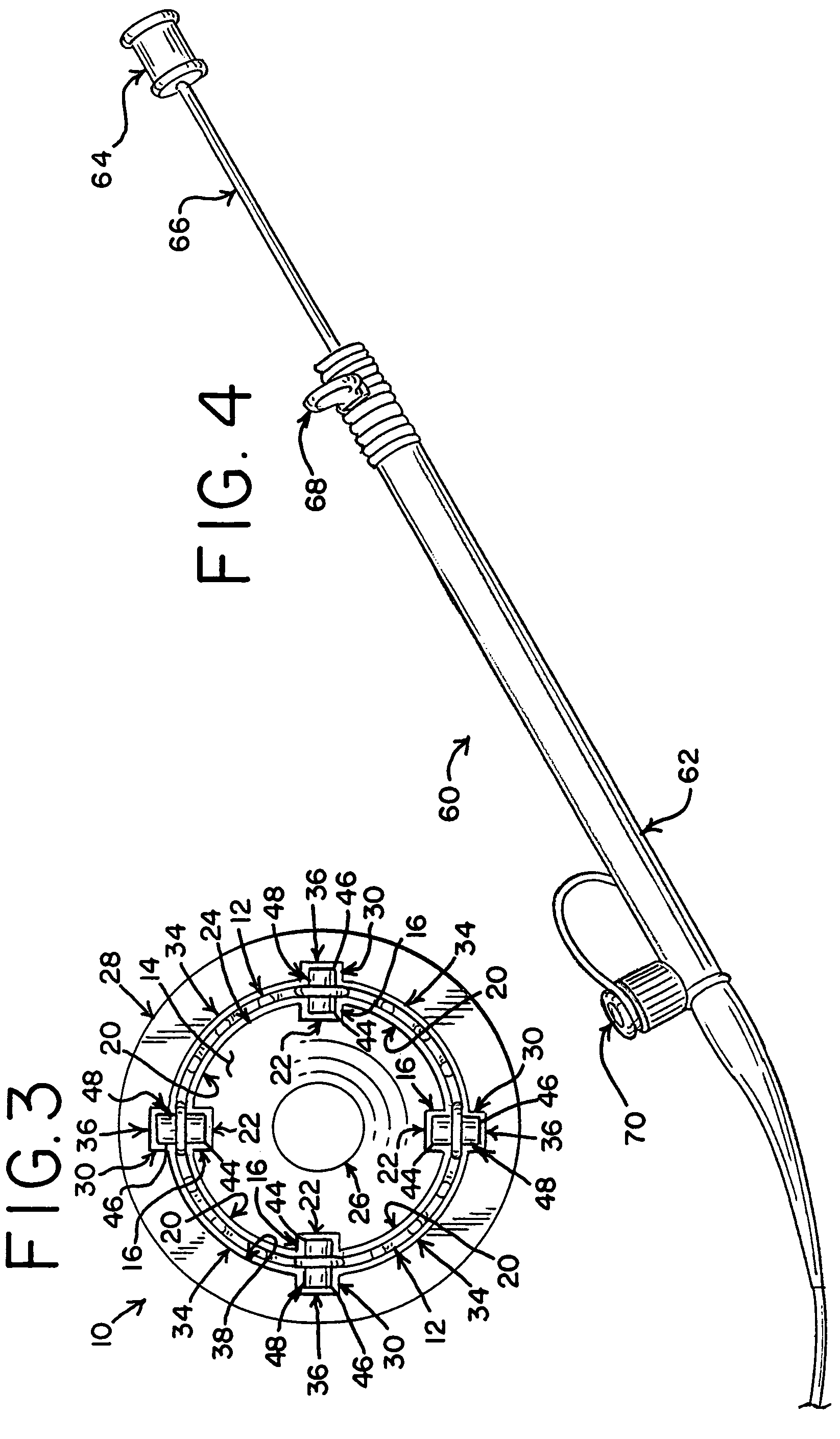 Delivery system with helical shaft