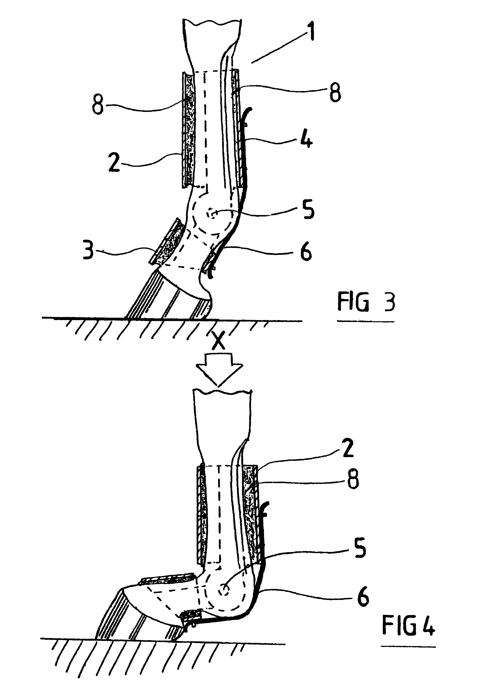 Tendon and ligament support for horse's fetlock joint