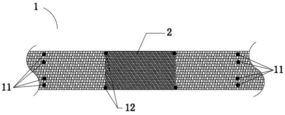 Nanometer electrospinning fiber stent for intravascular interventional therapy of intracranial aneurysm