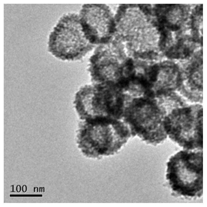 Photoresponsive degradable hollow mesoporous silicone nanocomposite particles and its preparation method and application