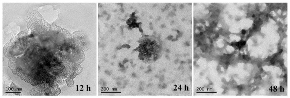 Photoresponsive degradable hollow mesoporous silicone nanocomposite particles and its preparation method and application