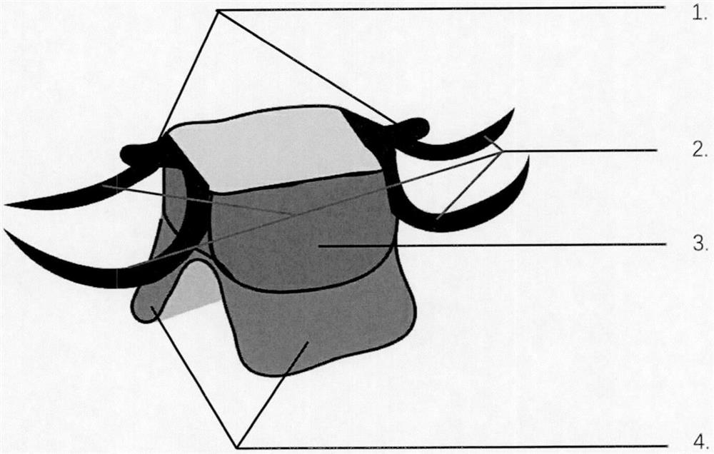 Moving device and method for depressing overlong maxillary posterior teeth