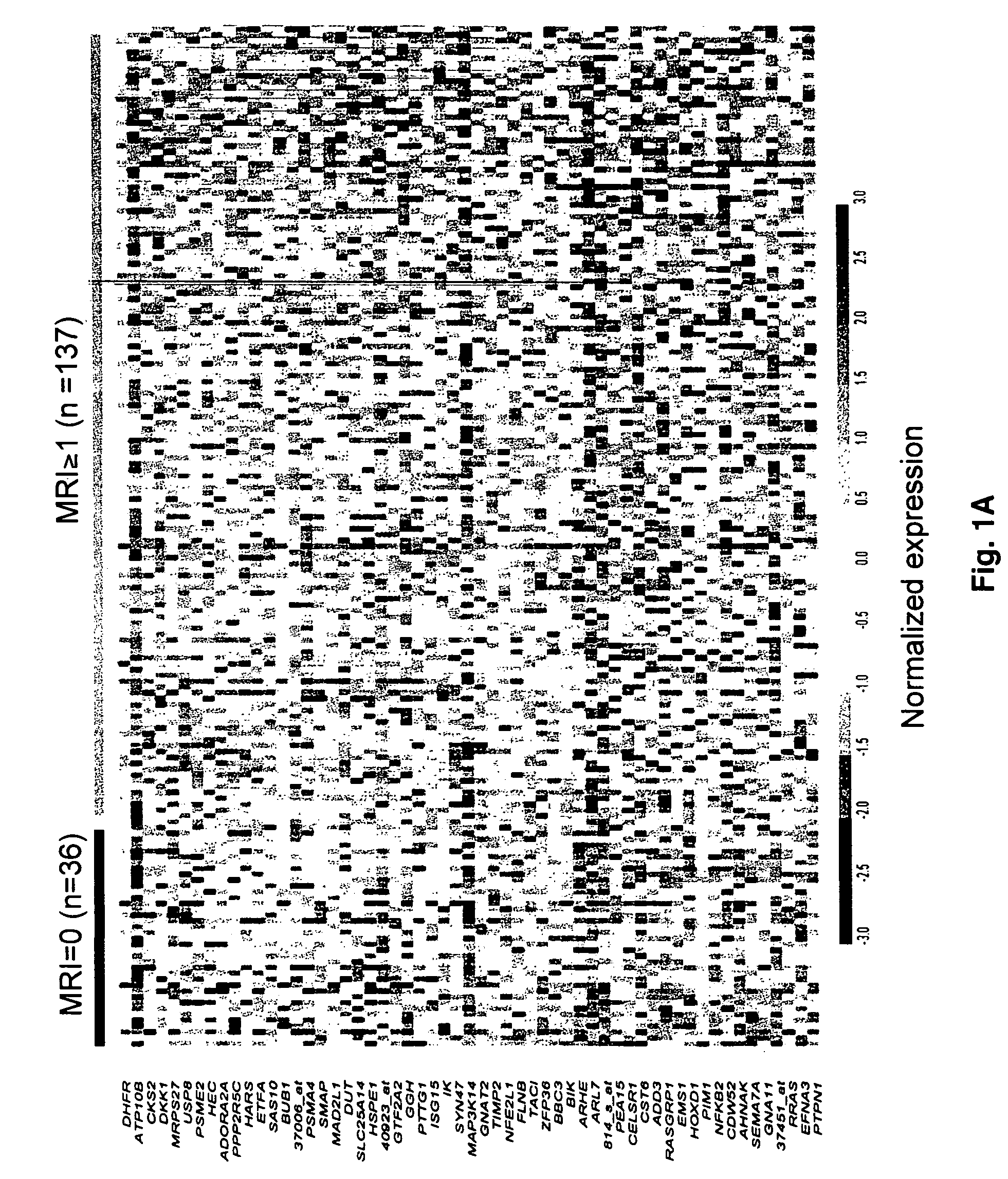 Molecular determinants of myeloma bone disease and uses thereof