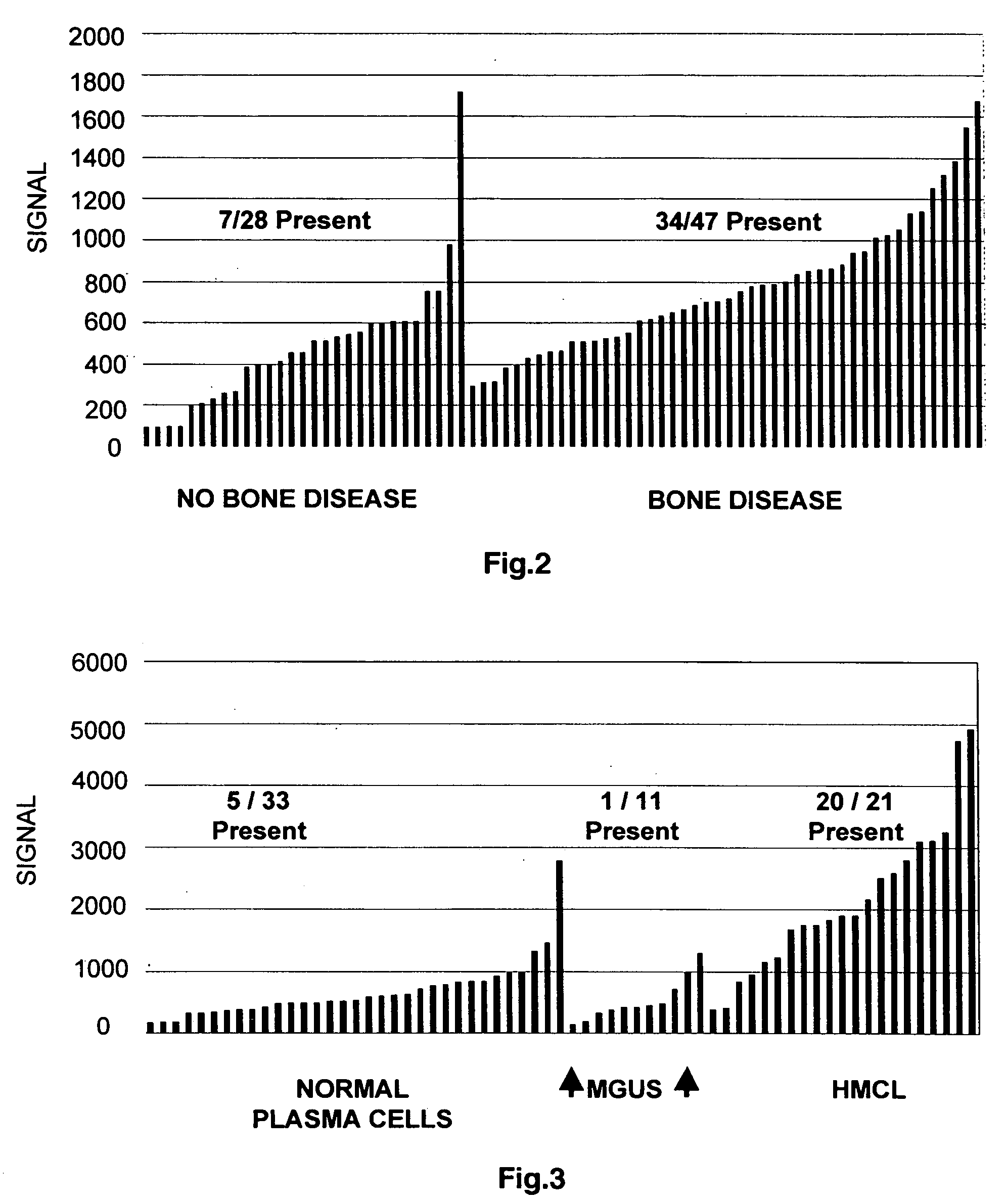 Molecular determinants of myeloma bone disease and uses thereof