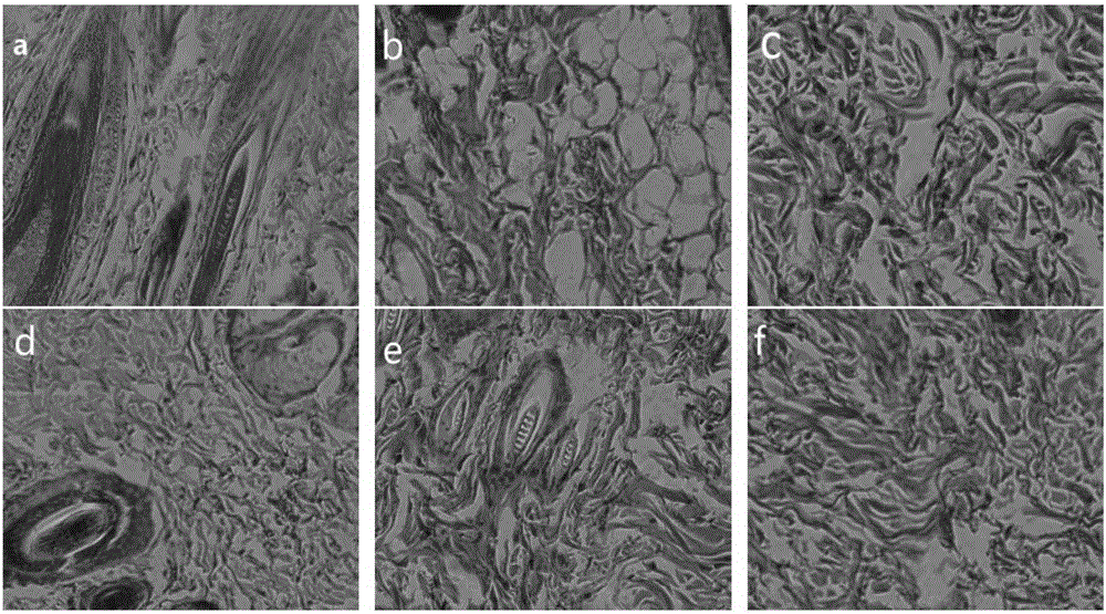 A kind of medicinal dressing hydrogel composite fabric and its preparation method and application