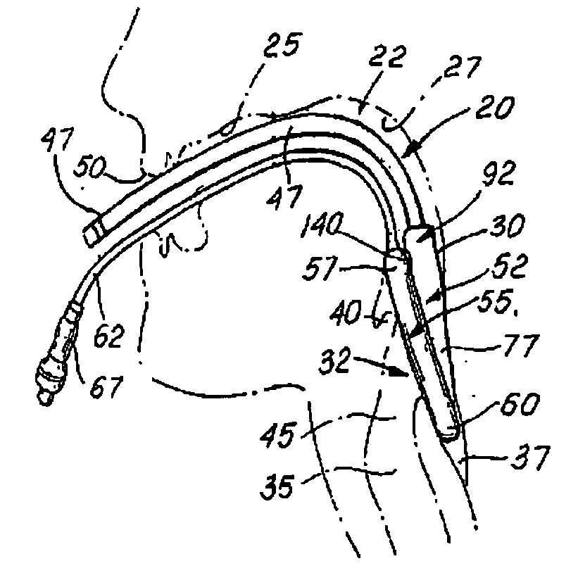 Laryngeal mask airway device