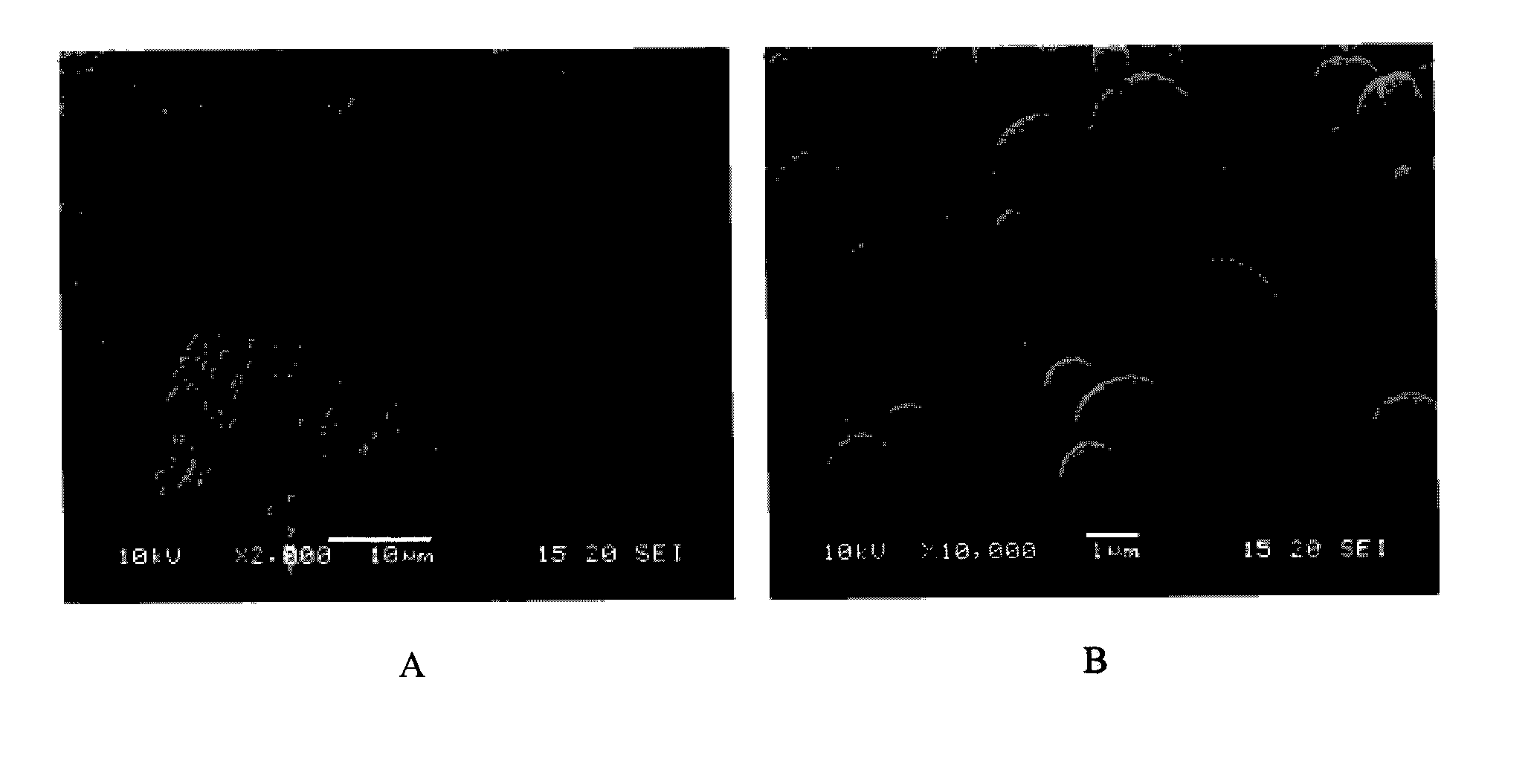 Inhalation particles comprising a combination of an anticholinergic, a corticosteroid and a beta-adrenergic