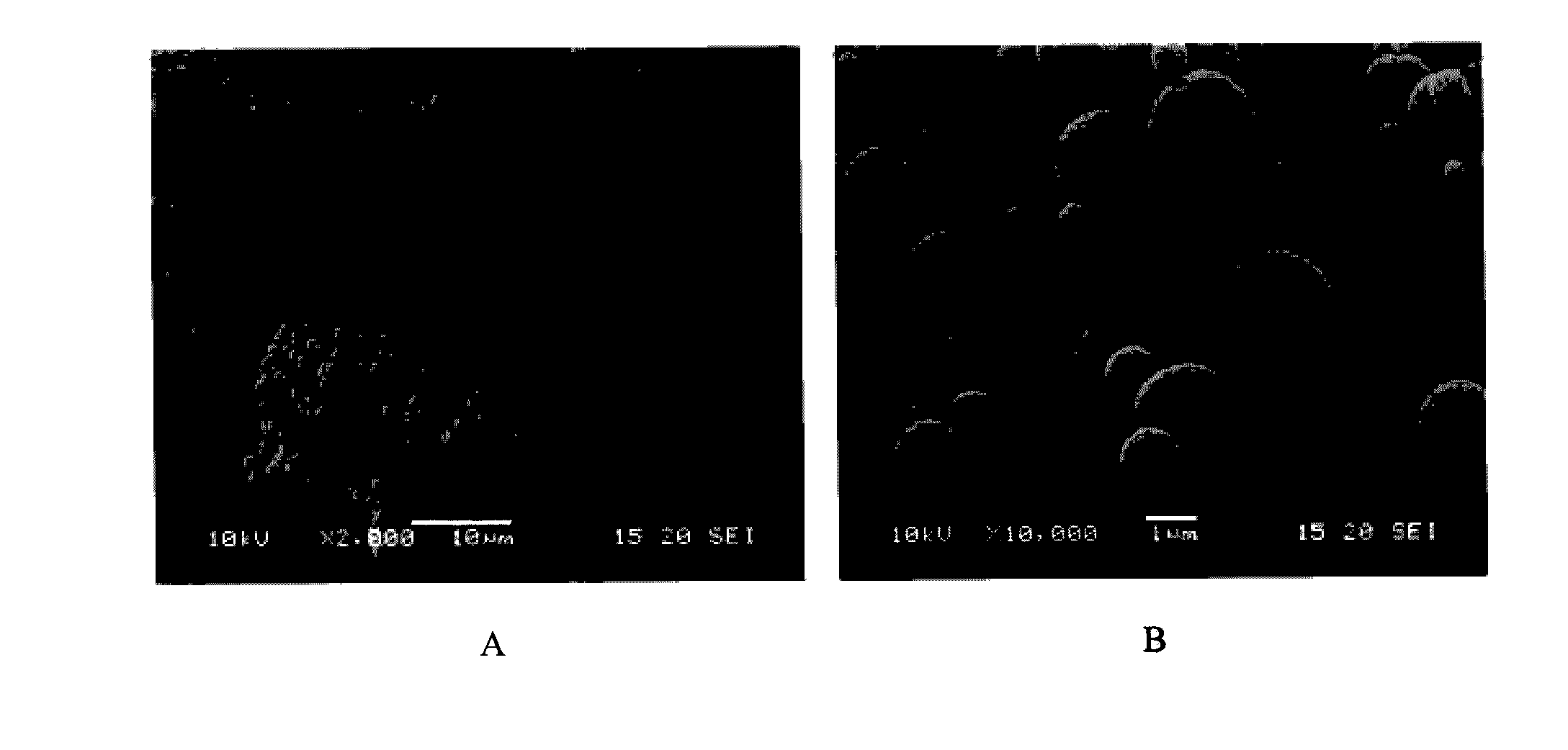 Inhalation particles comprising a combination of an anticholinergic, a corticosteroid and a beta-adrenergic