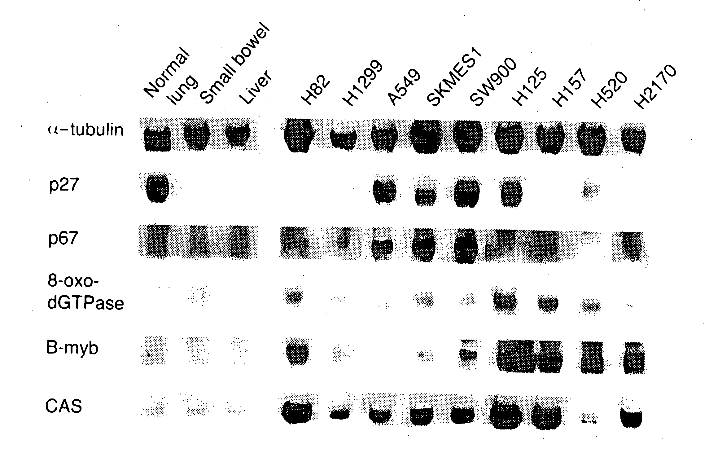 Methods for the diagnosis and treatment of lung cancer