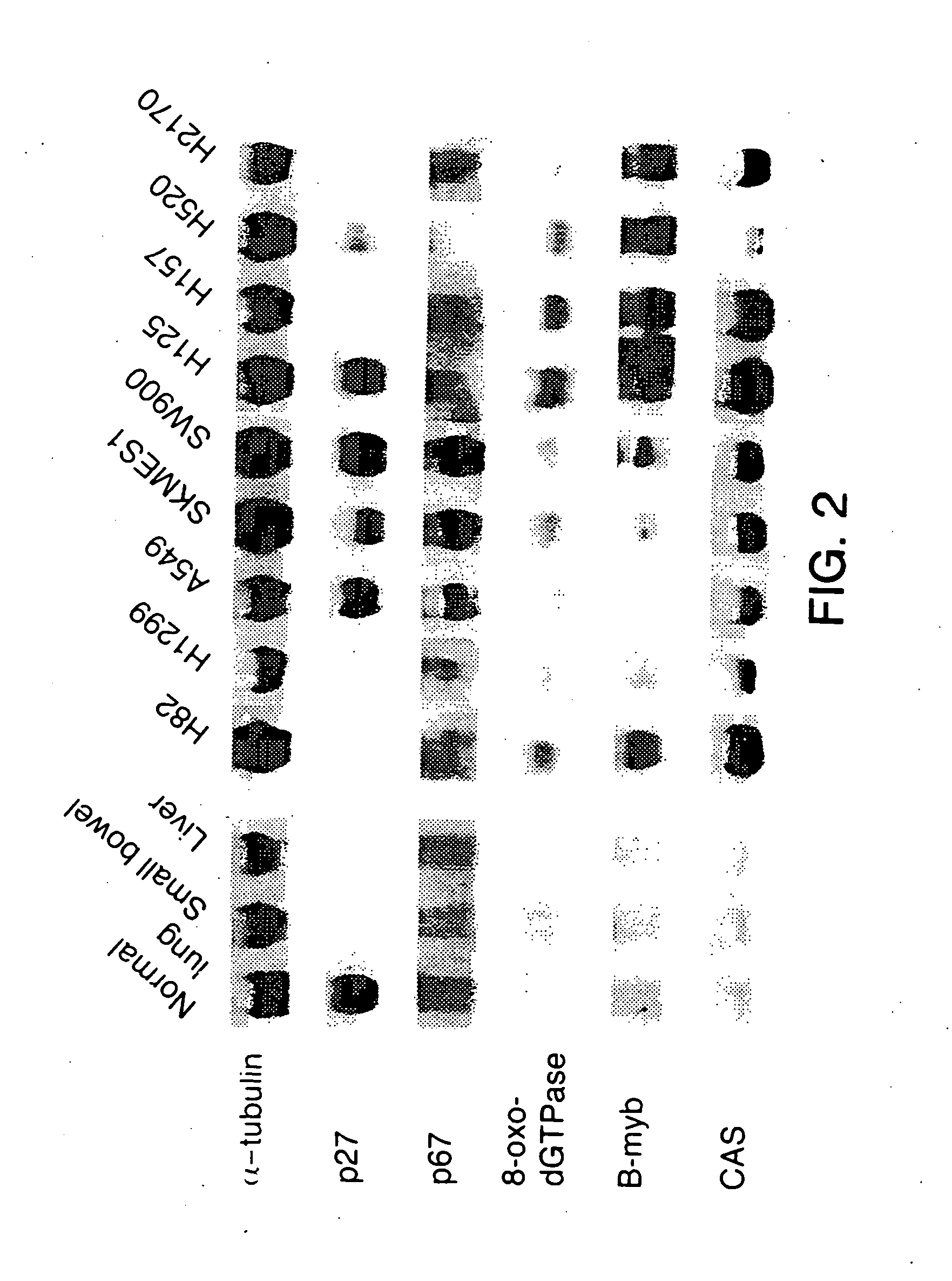 Methods for the diagnosis and treatment of lung cancer