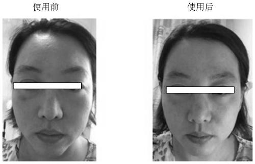 Skin compound preparation