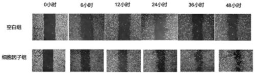 Skin compound preparation