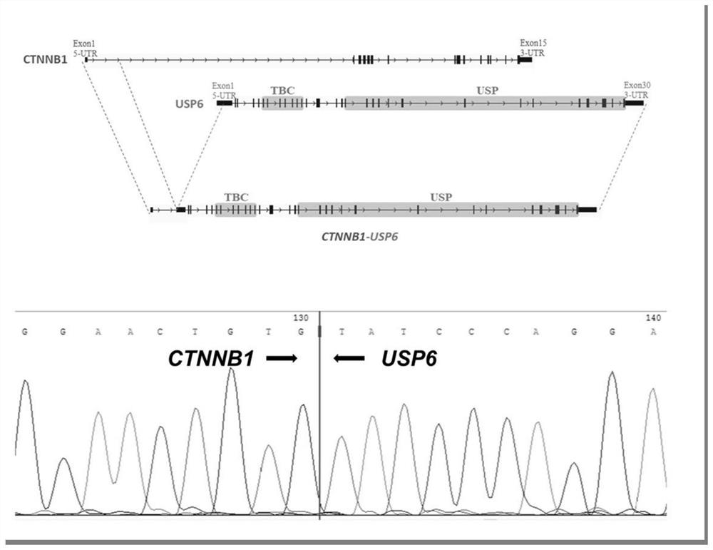 Design kit for targeted detection of small round cell tumor fusion gene panel of soft tissue tumor