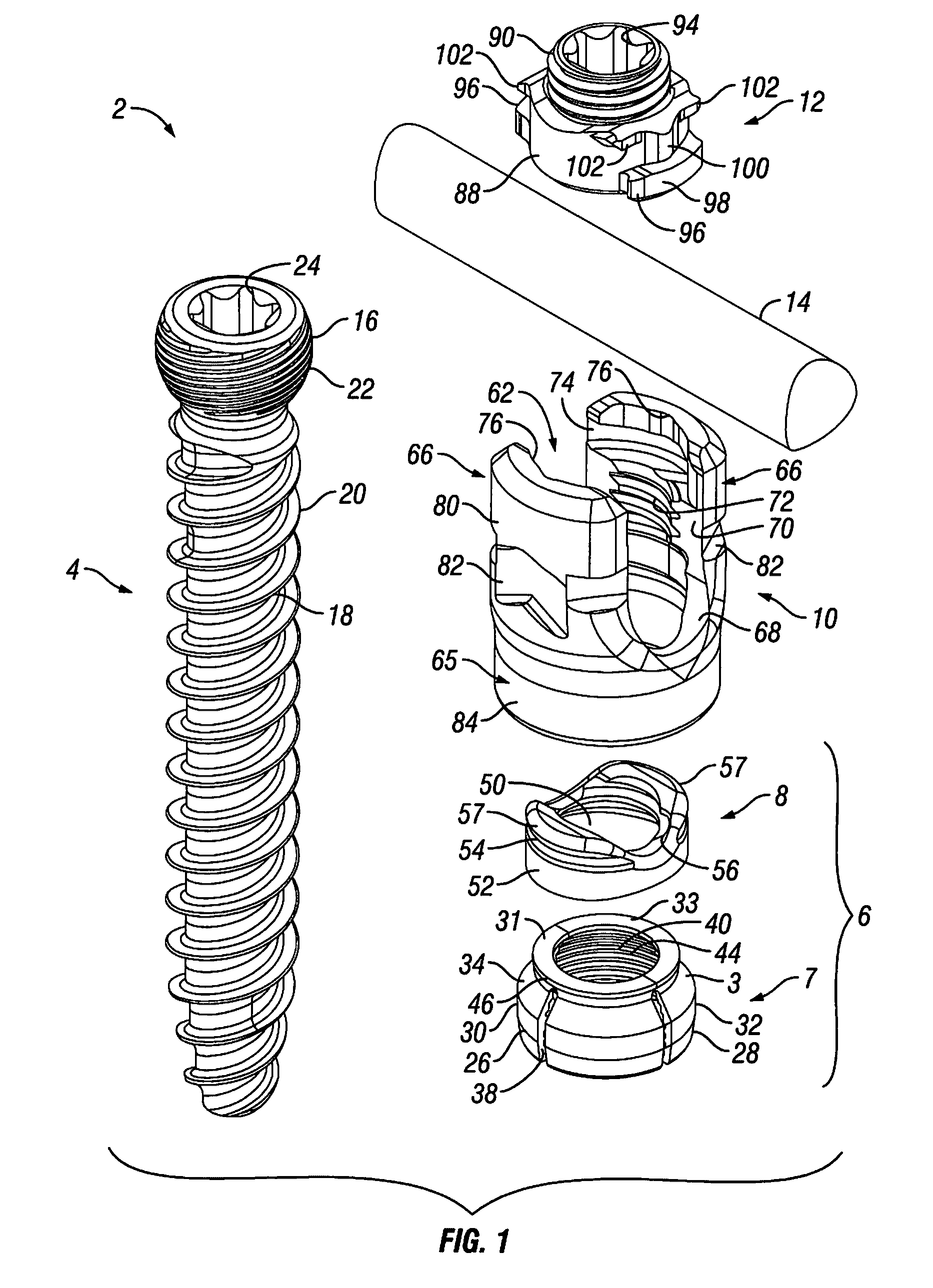 Orthopedic fixation devices and methods of installation thereof