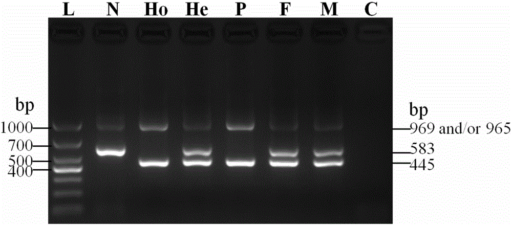 Citrin immunodeficiency disease pathogenic gene SLC25A13 high-frequency I-type mutation screening primers and kit