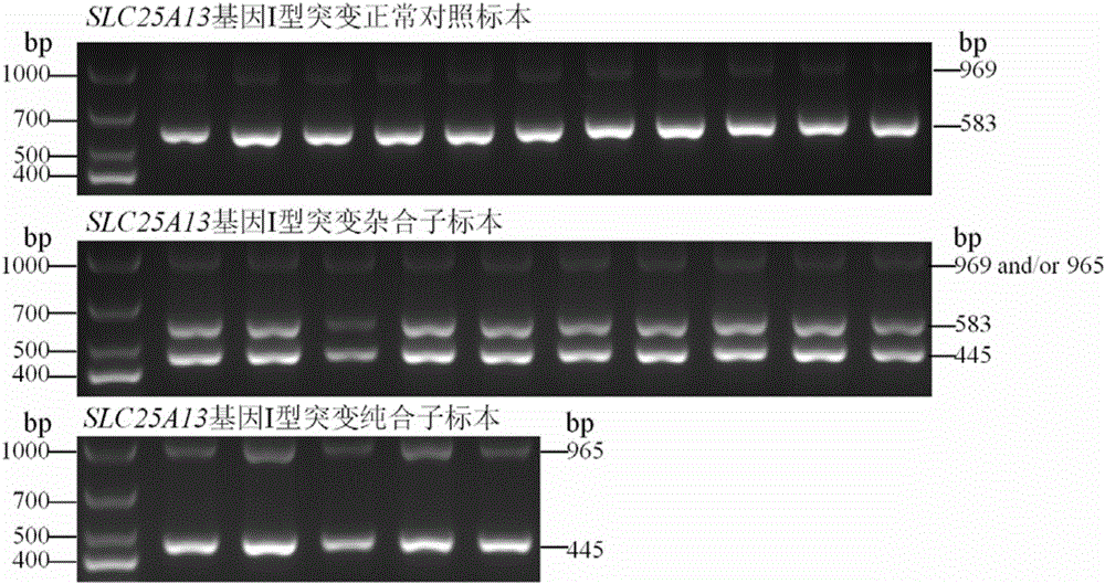 Citrin immunodeficiency disease pathogenic gene SLC25A13 high-frequency I-type mutation screening primers and kit