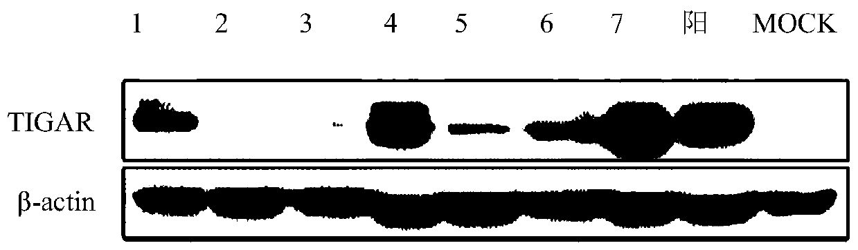 BHK cell line stably expressing hamster TIGAR gene, and construction method and application thereof