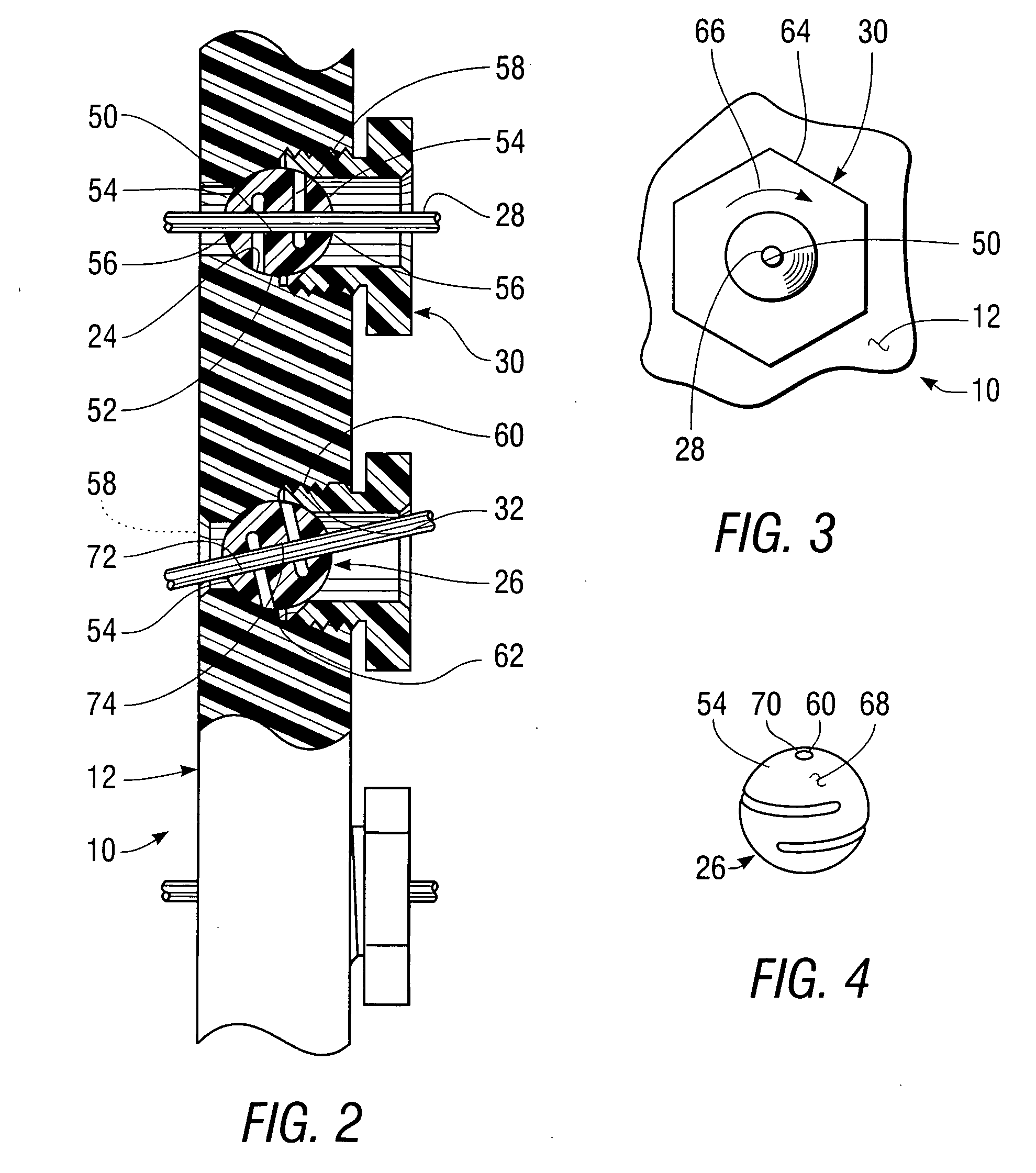 Apparatus for external fixation of a fractured distal radius with angularly adjustable pin clamping means