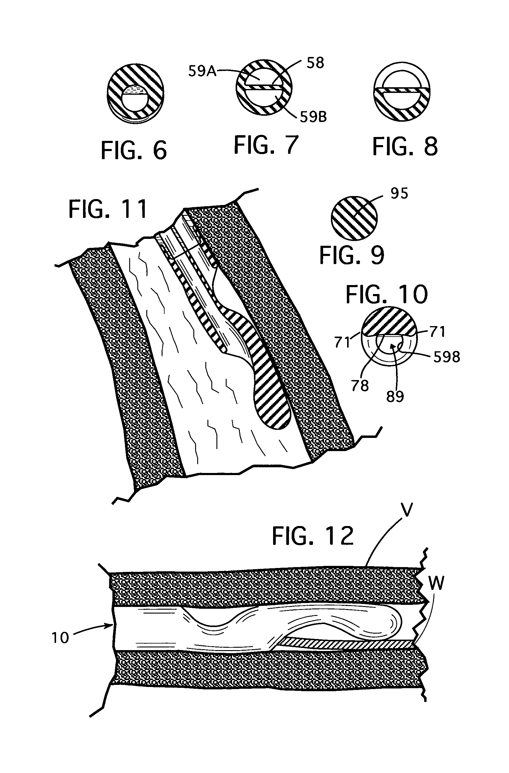 Catheter