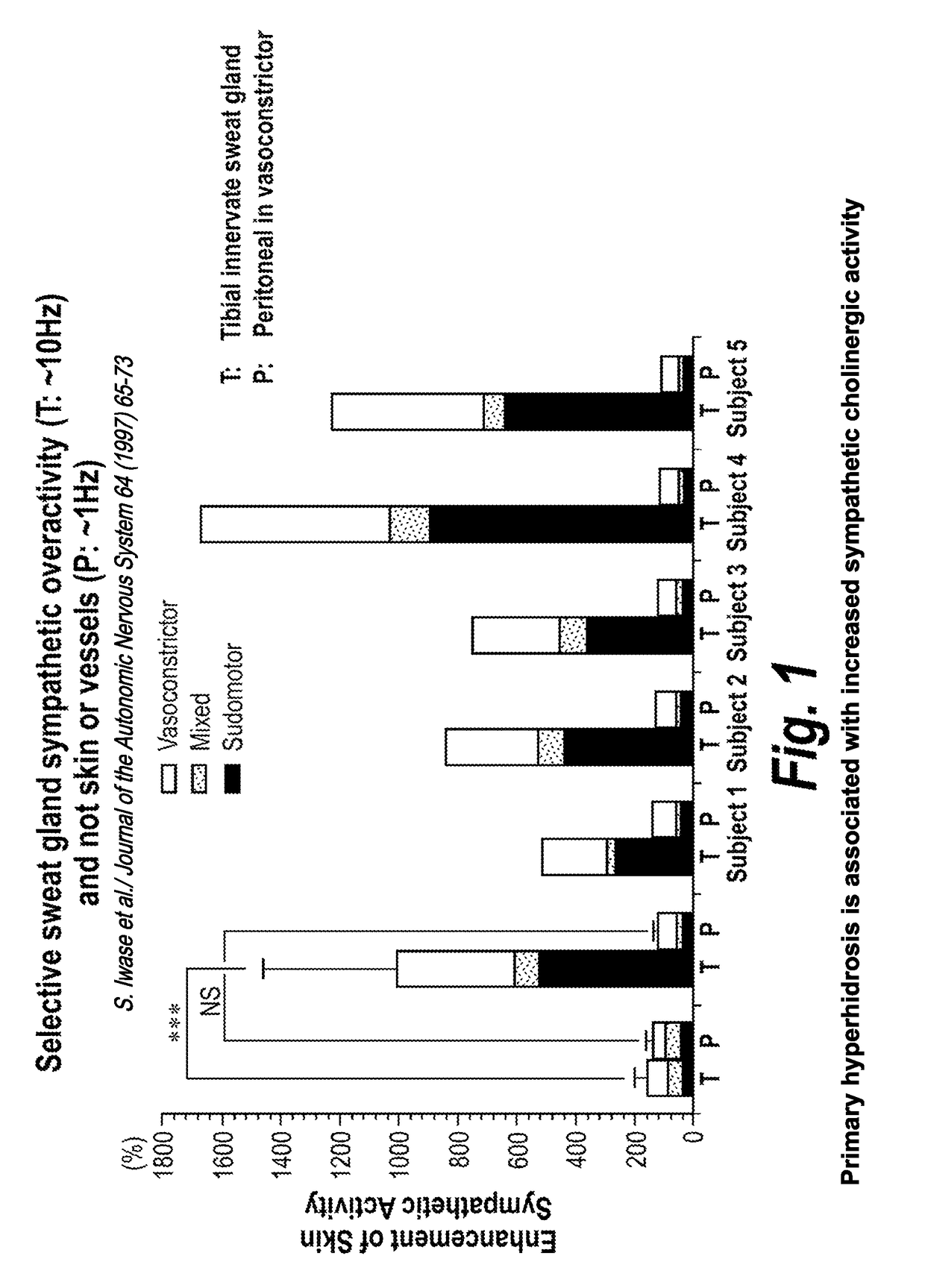 Method for treating hyperhidrosis with dexmecamylamine