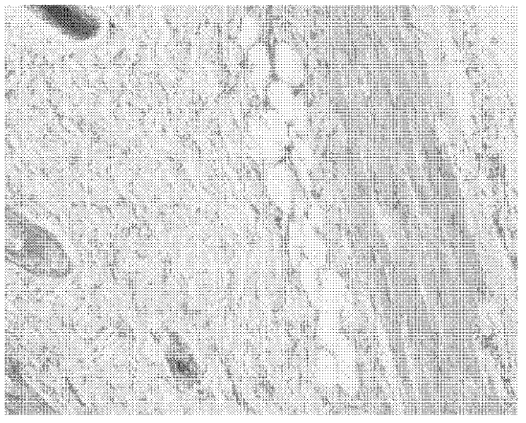 Compound pharmaceutical composition of iodine polymer and glucocorticosteroid for treating dermatitis