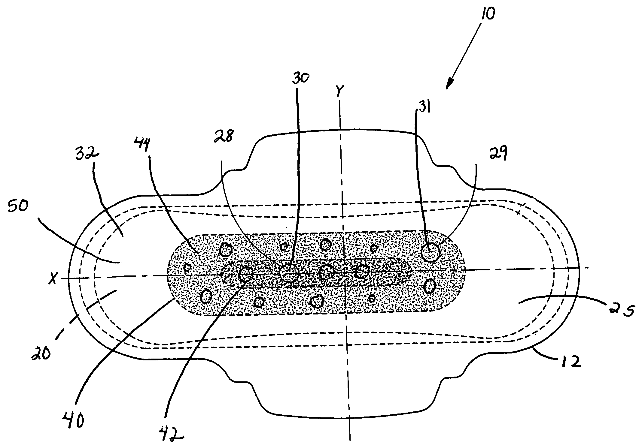 Absorbent article