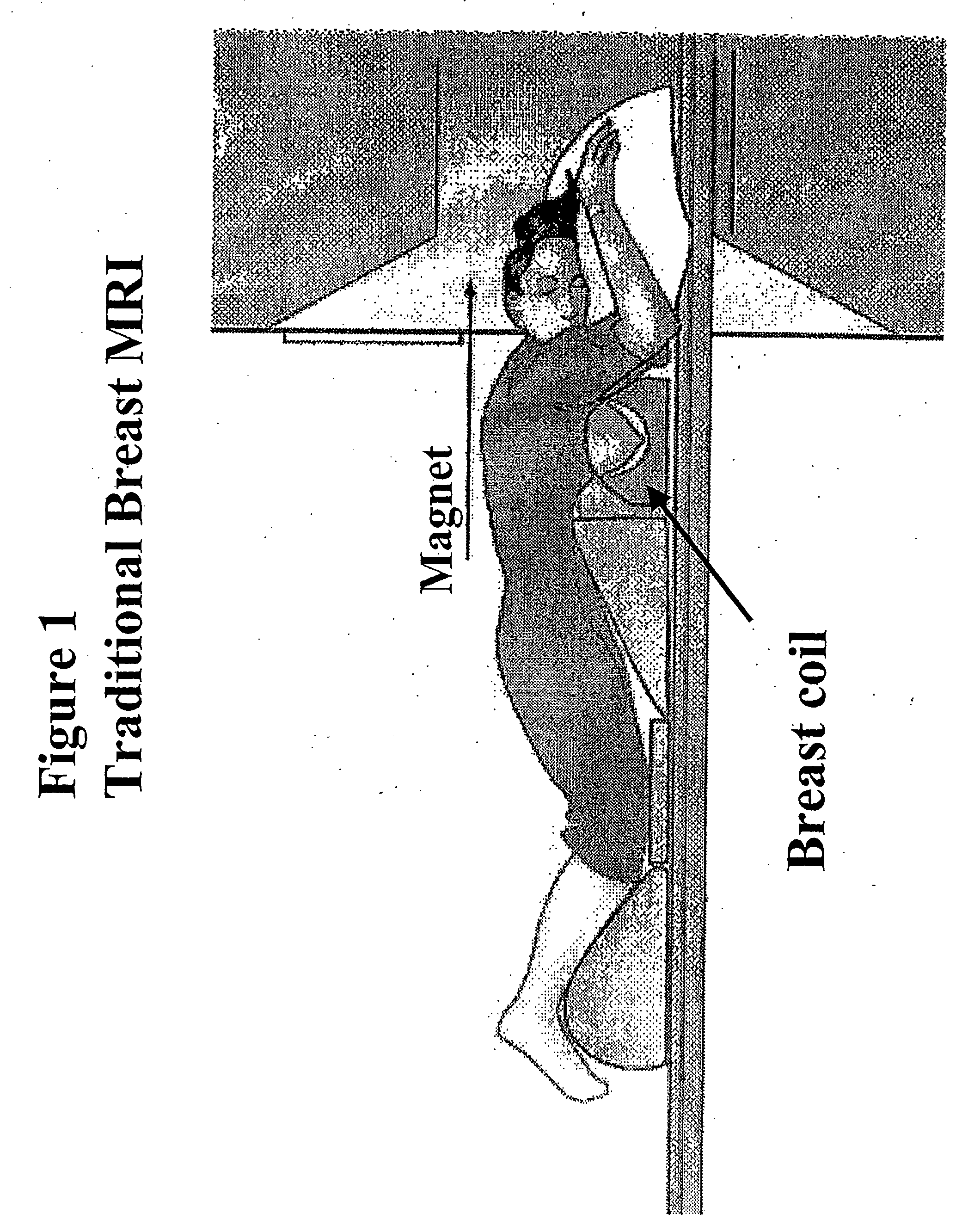 Magnetic resonance imaging device