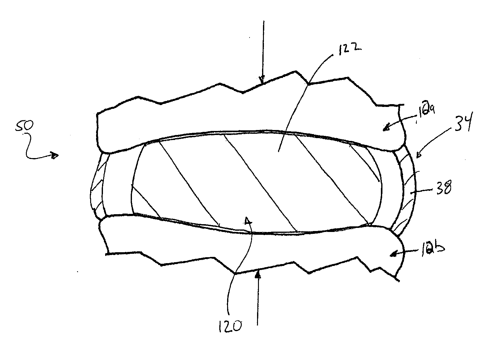 Systems and methods for stabilizing a functional spinal unit