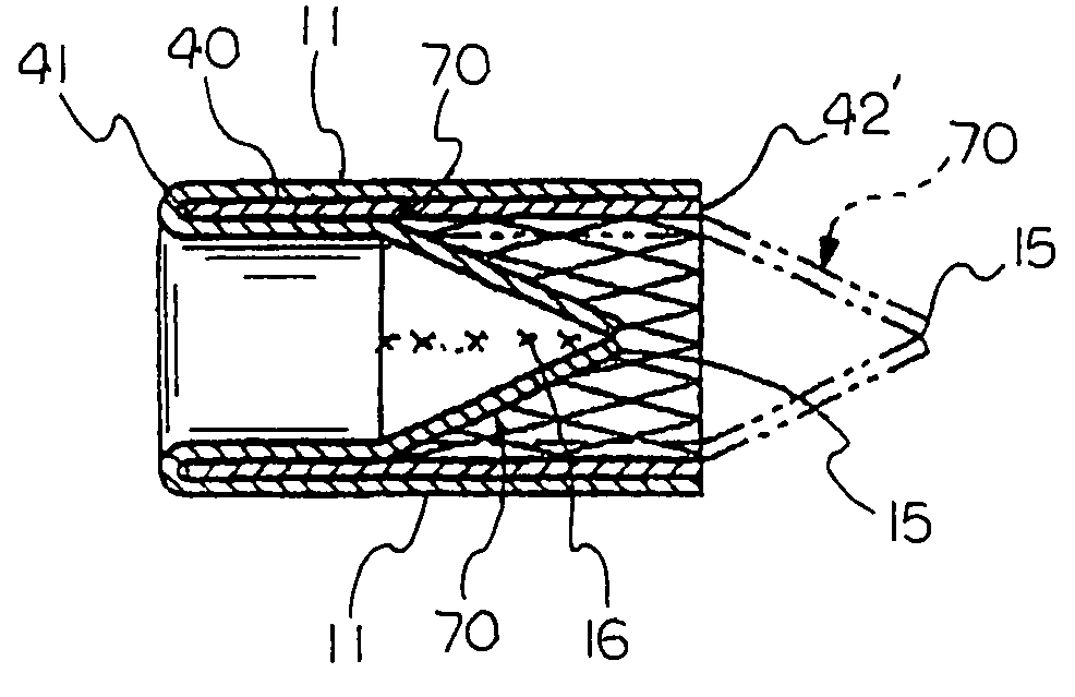 Prosthetic valve devices and methods of making such devices