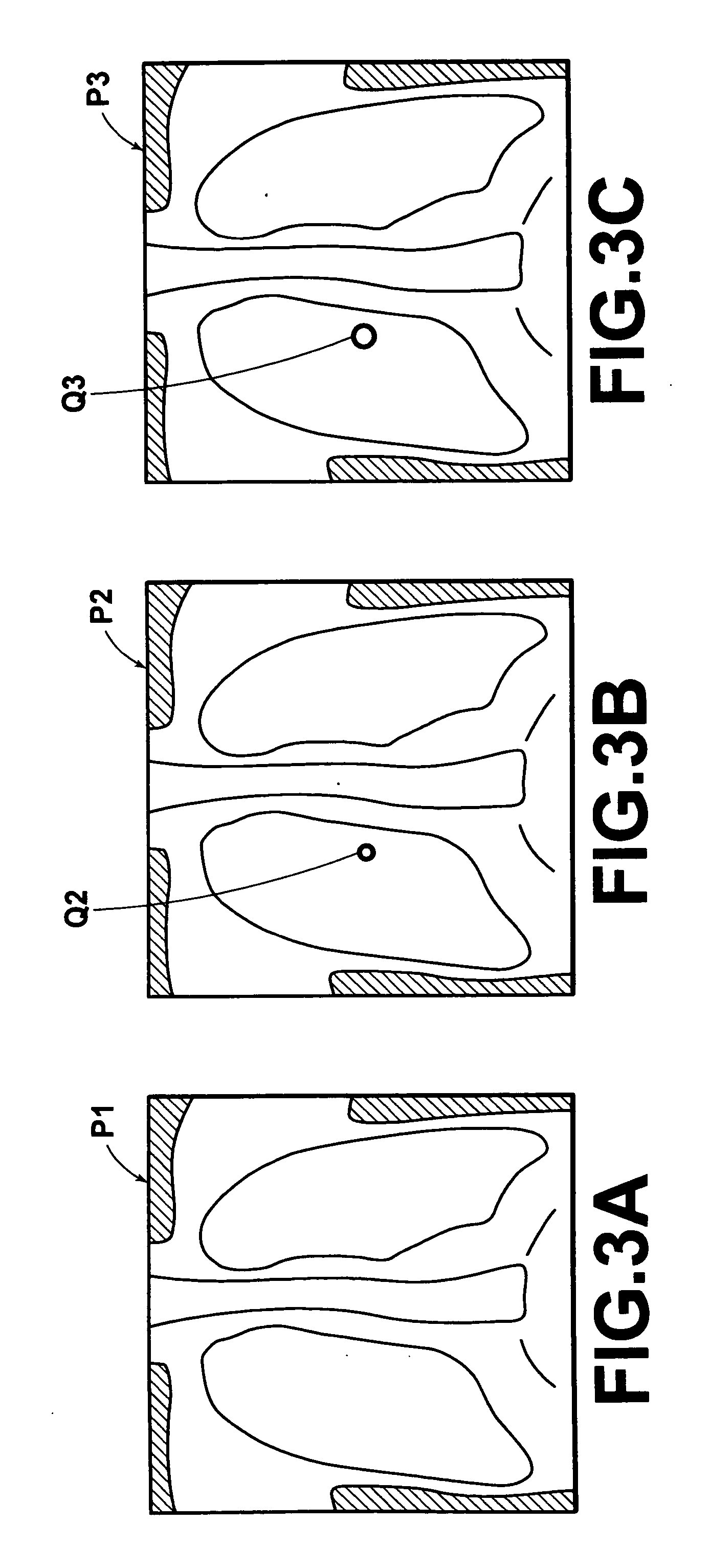 Image display method, apparatus and program