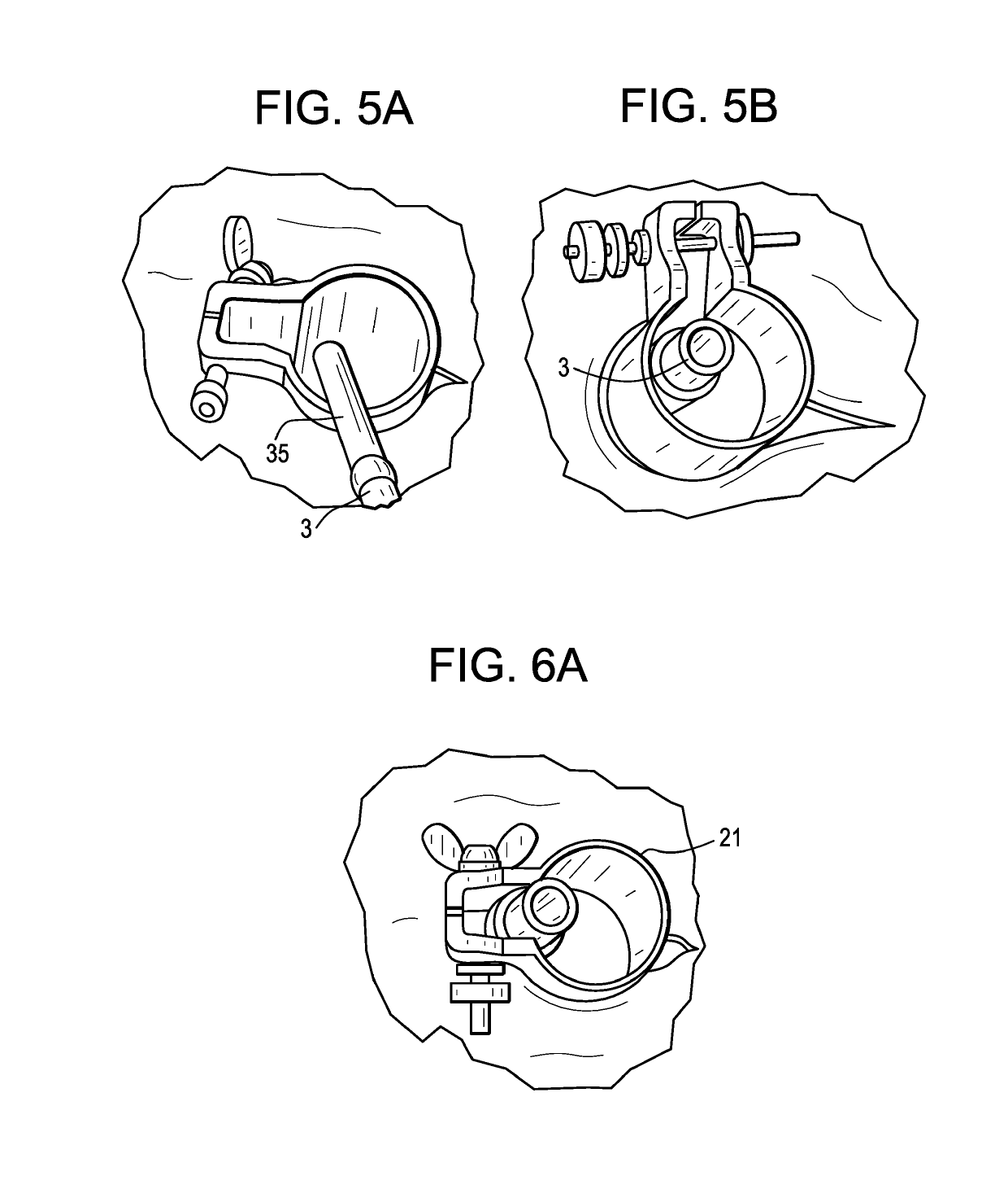 Method and instruments for interbody fusion and posterior fixation through a single incision