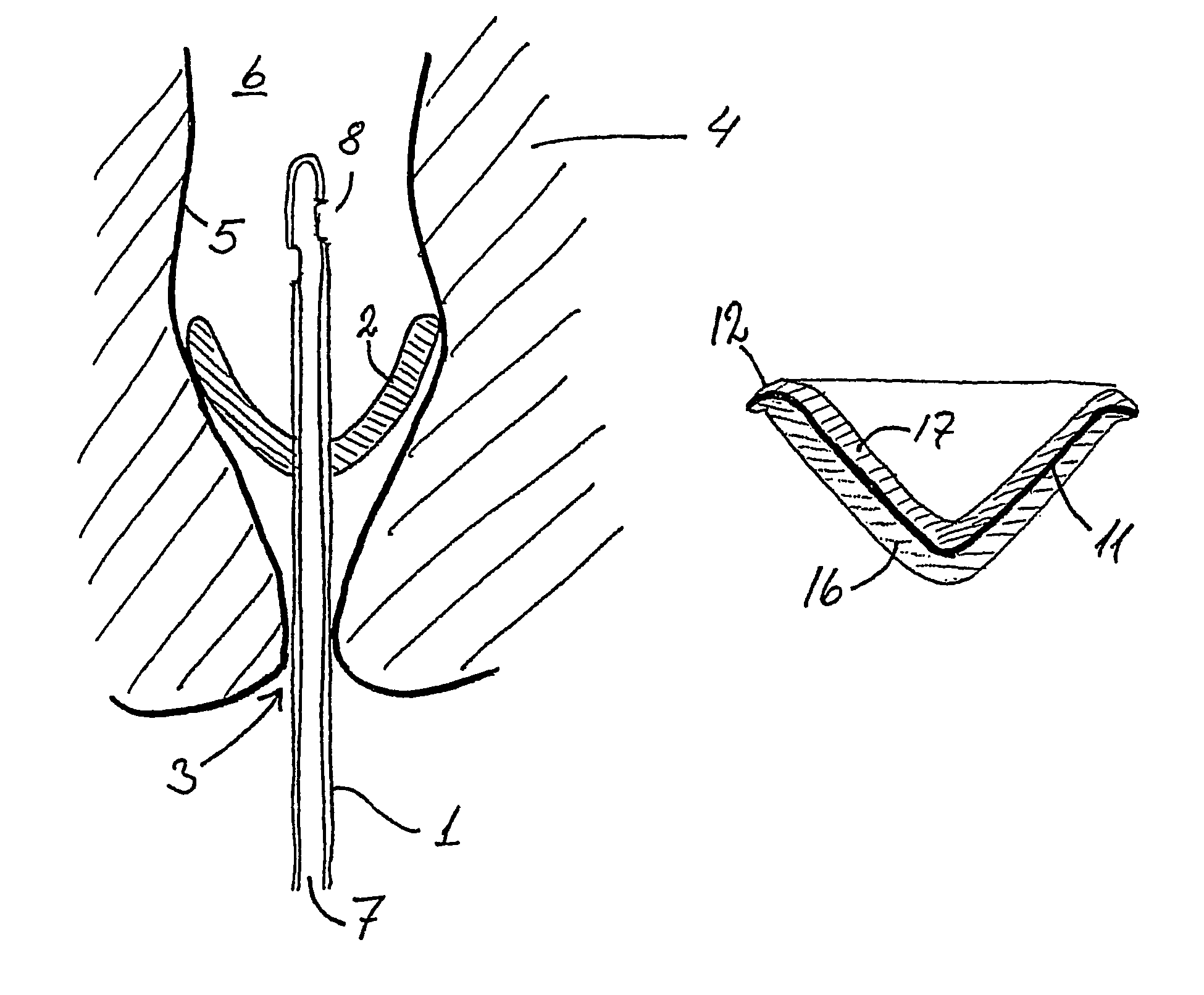 Sealing device