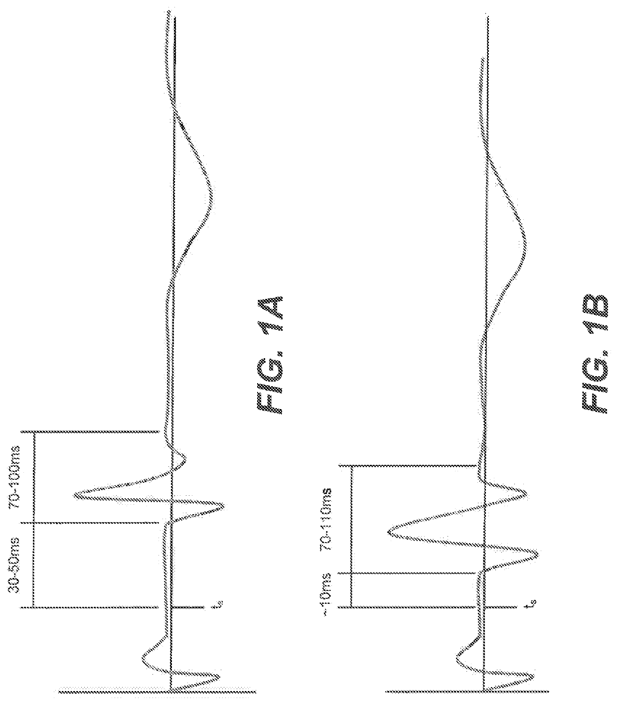 Systems and methods for automated capture threshold testing and associated his bundle pacing