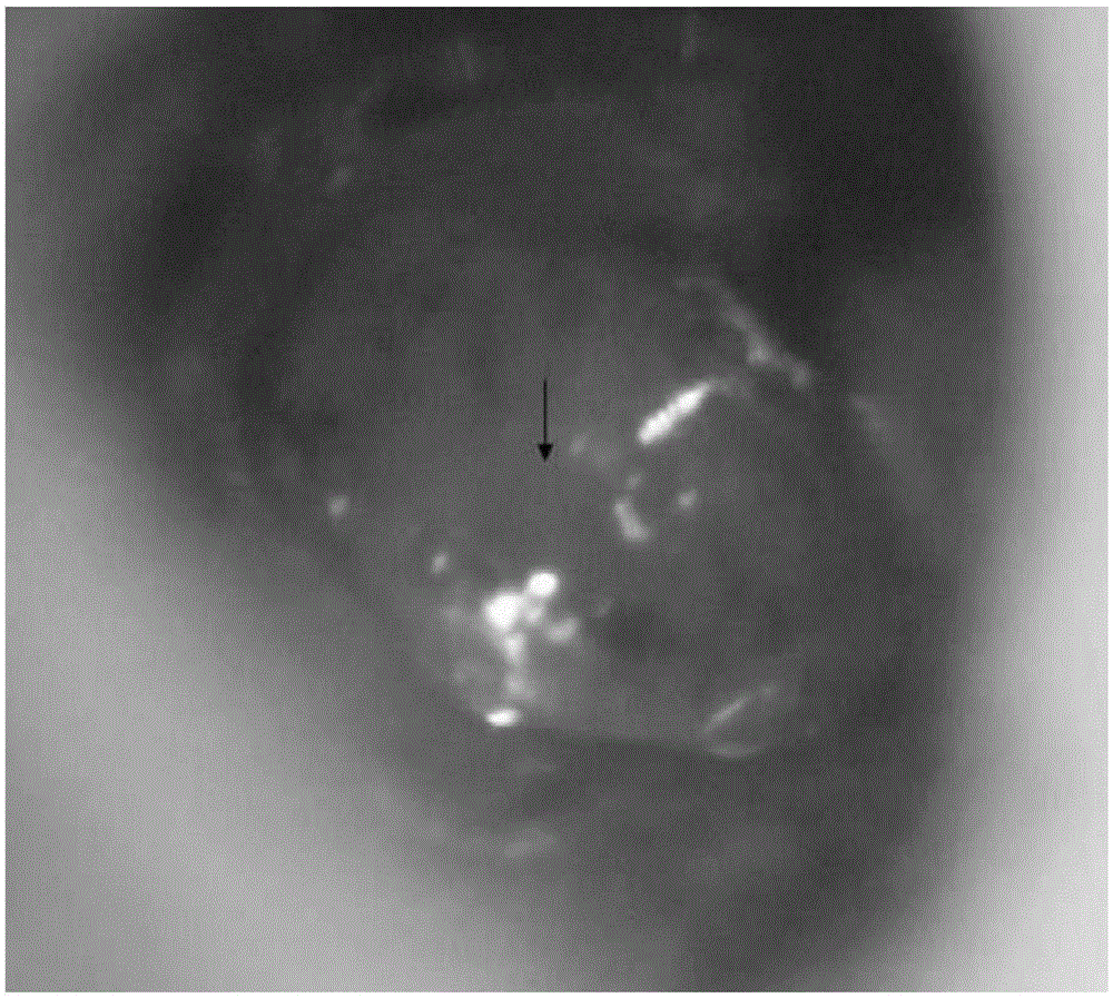 Manufacturing method for acellular dermal matrix tympanic membrane and external ear tissue repair material