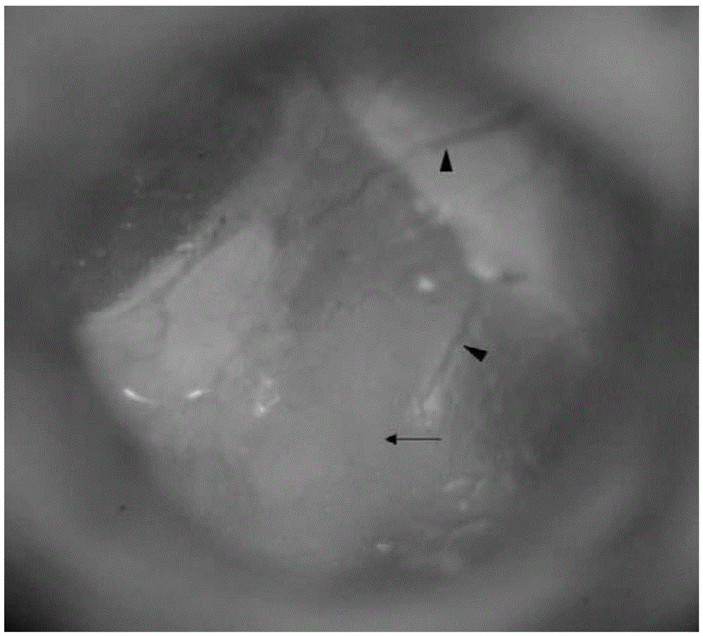 Manufacturing method for acellular dermal matrix tympanic membrane and external ear tissue repair material