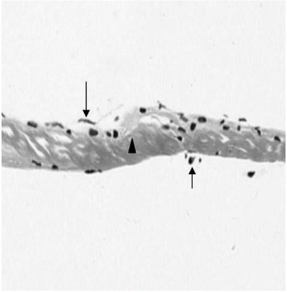 Manufacturing method for acellular dermal matrix tympanic membrane and external ear tissue repair material