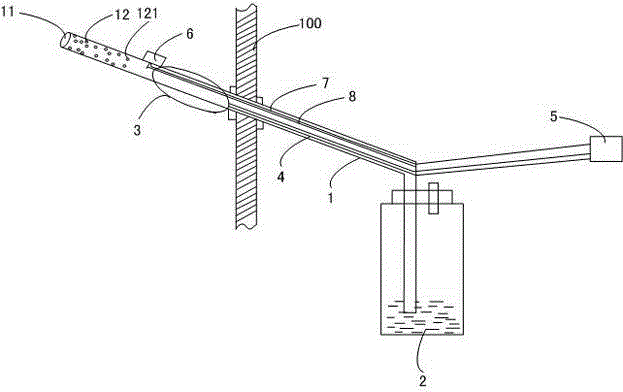 Respiration assistance thoracic cavity saccule counterpulsation drainage device and respiration assistance drainage method