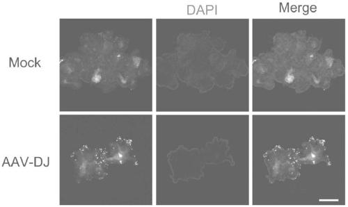 Usage of AAV-DJ type adeno-associated virus in-vitro efficient infection organoid