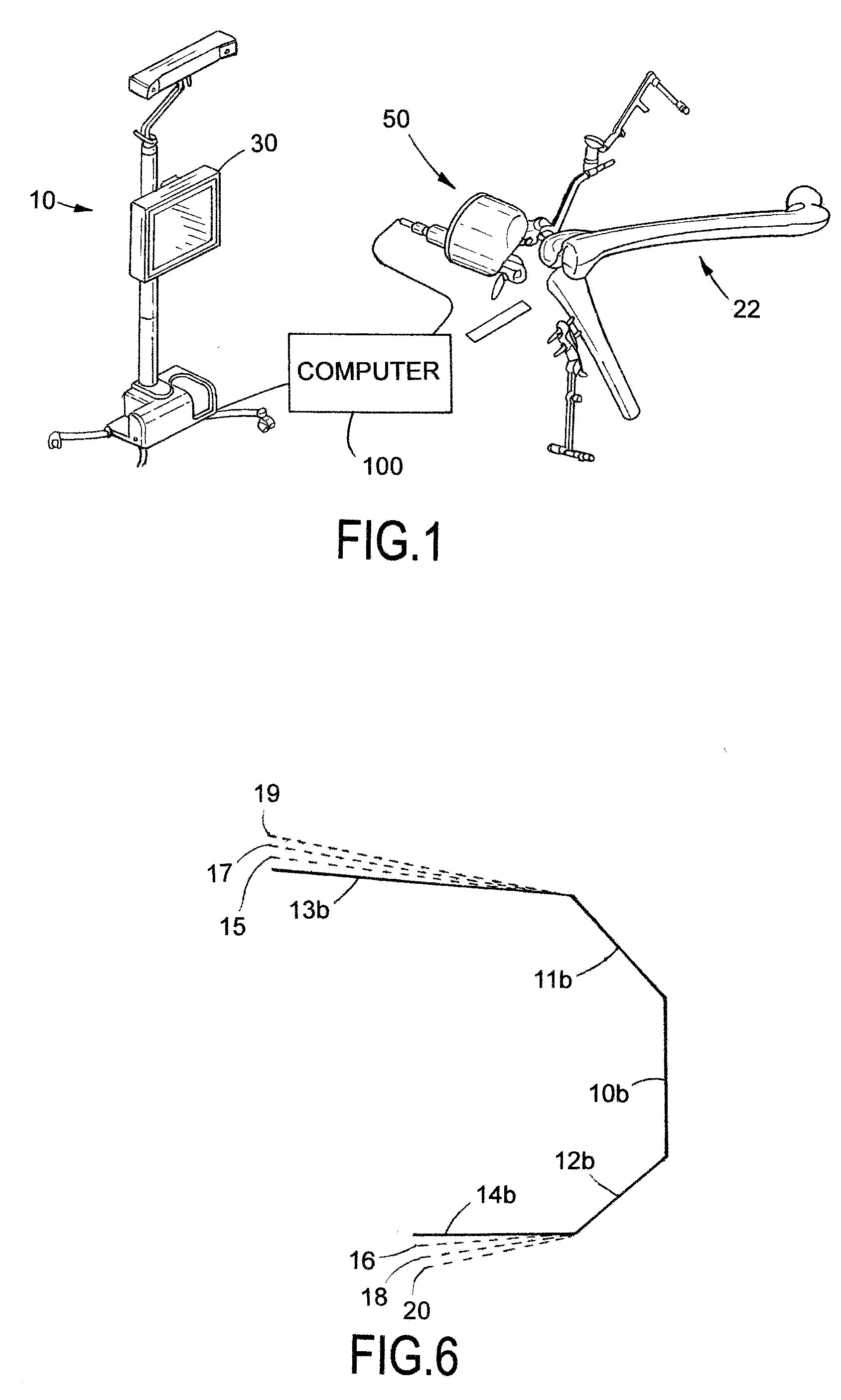 System and method for bone preparation for an implant