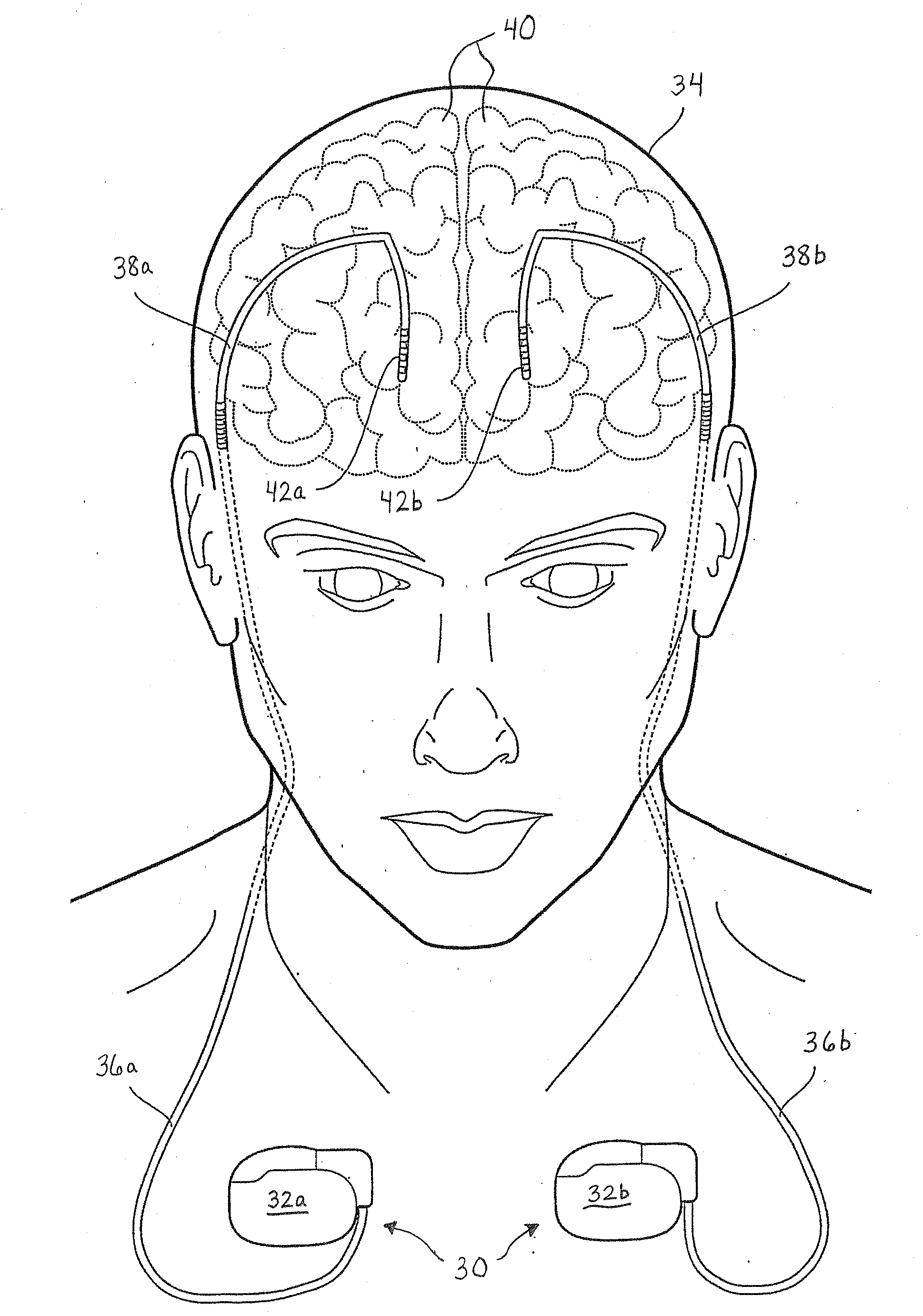 Continuous conductive materials for electromagnetic shielding