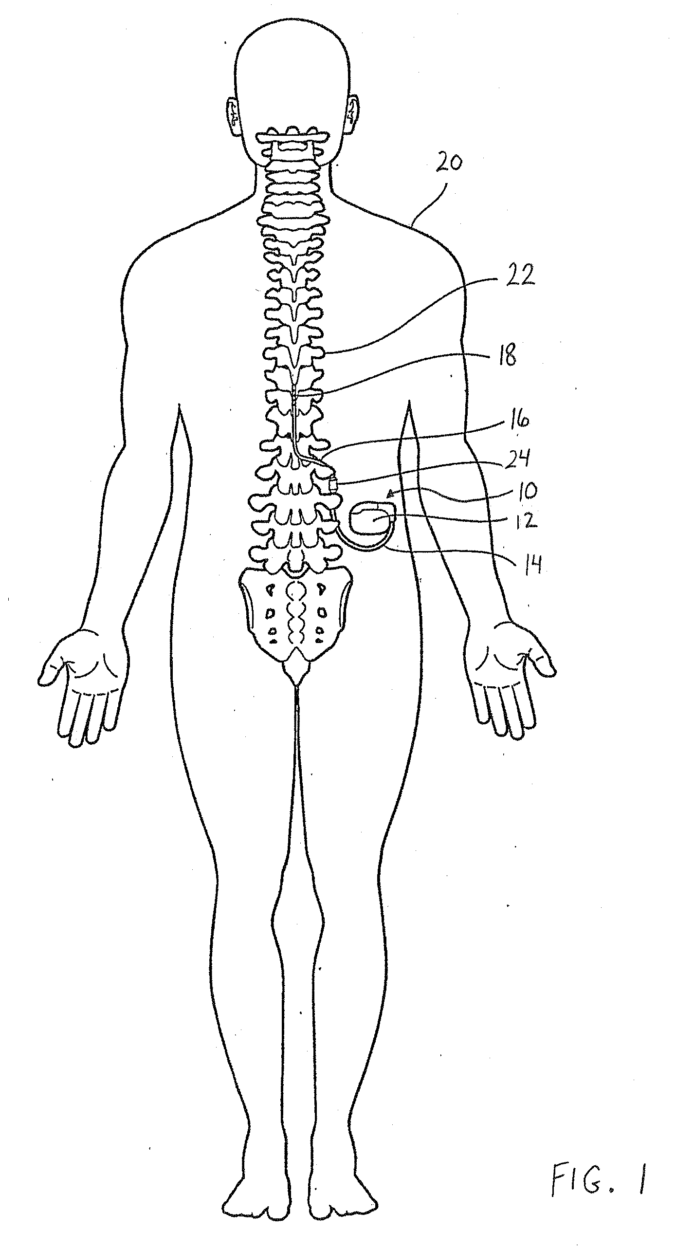 Continuous conductive materials for electromagnetic shielding