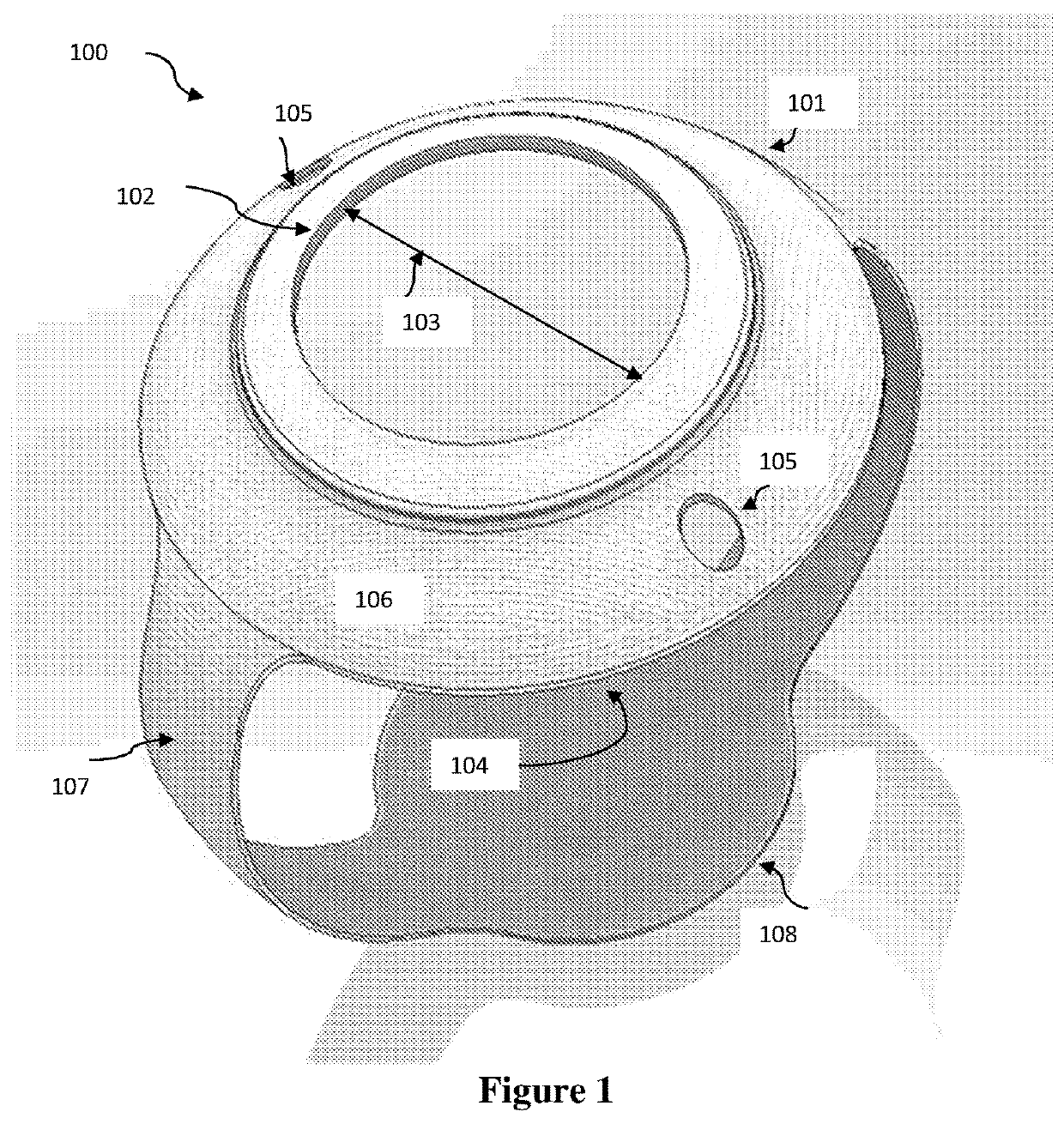 Graft patch for the treatment of myopia and ophthalmic conditions