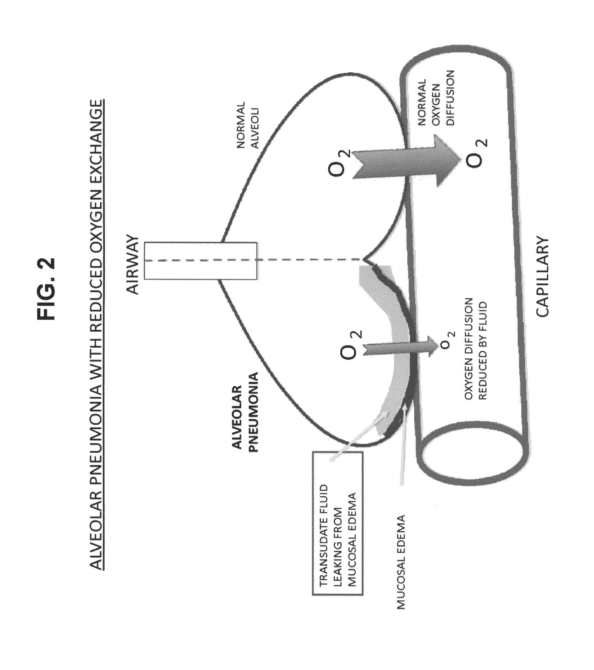 Compositions and methods for treatment of pulmonary diseases and conditions