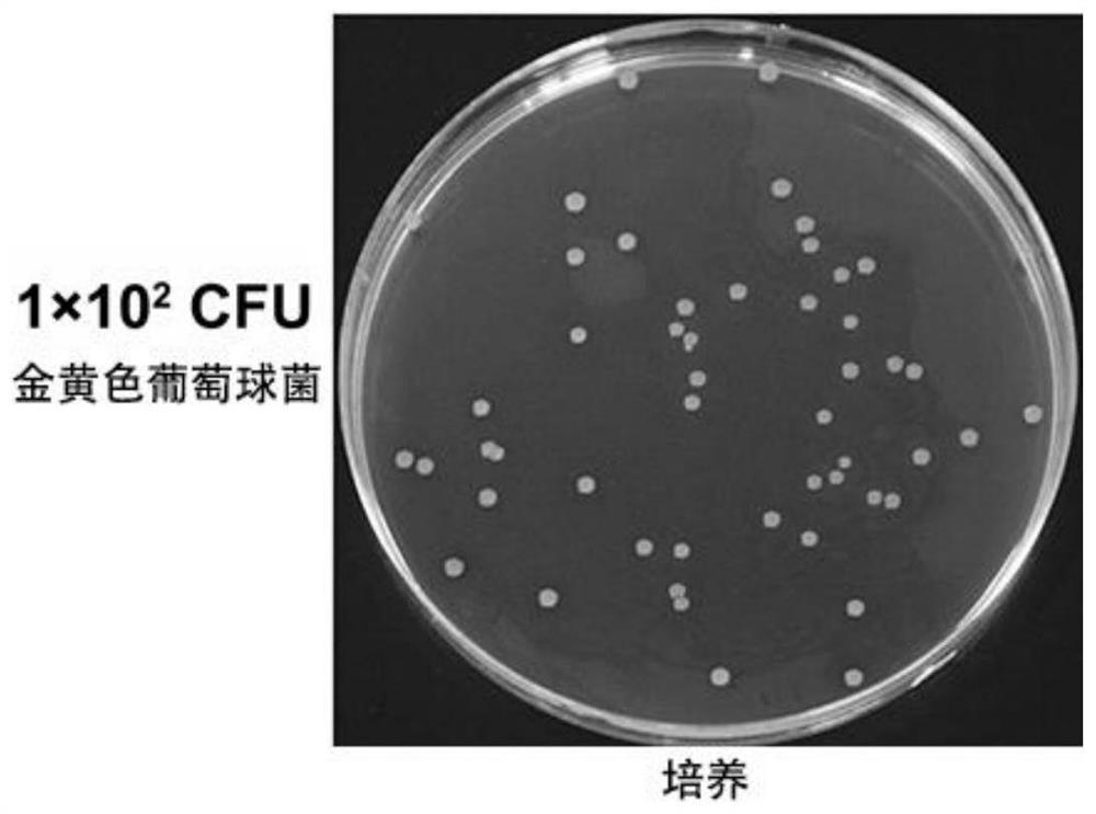 A kind of bacteria detection kit and its application