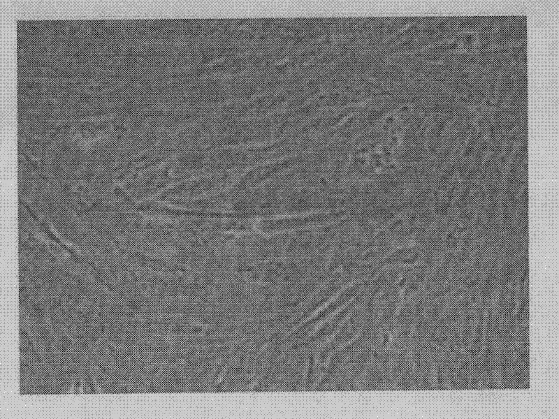 Method for preparing porcine hepatocyte and mesenchymal stem cell co-microencapsulated internal bio-artificial liver