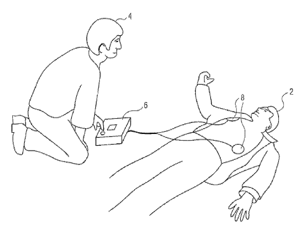 External defibrillator with shock activated by cessation of precordial compressions